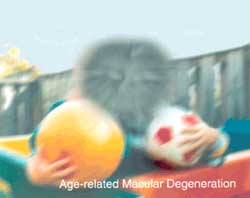 Example Of Vision With Macular Degeneration